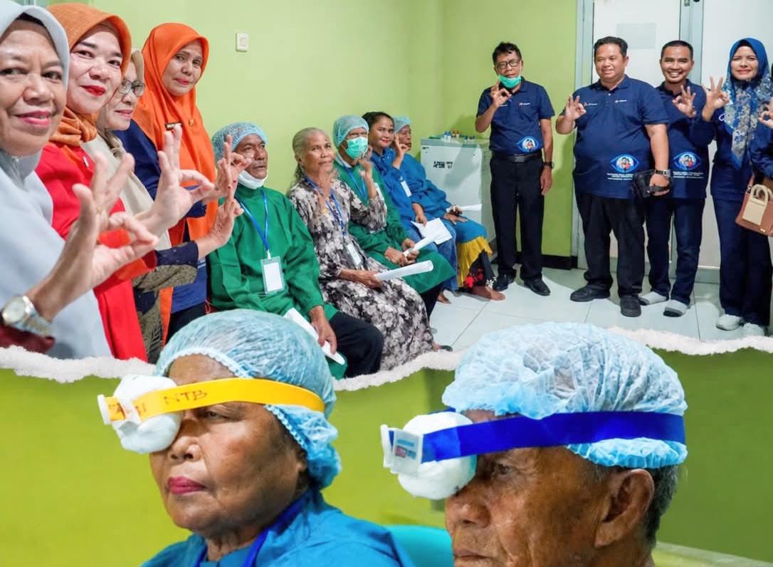 Peringati Hari Penglihatan Sedunia, RSUD Dompu Gelar Operasi Katarak Gratis untuk 300 Pasien